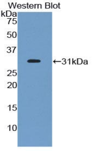 EPHA1 / EPH Receptor A1 Antibody - Western blot of recombinant EPHA1 / EPH Receptor A1.  This image was taken for the unconjugated form of this product. Other forms have not been tested.