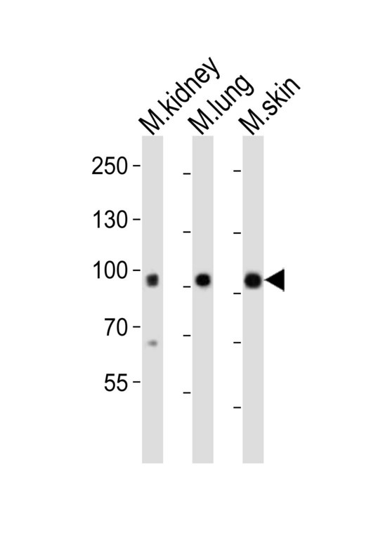 EPHA1 / EPH Receptor A1 Antibody - Western blot of lysates from mouse kidney, mouse lung, mouse skin tissue (from left to right) with Epha1 Antibody. Antibody was diluted at 1:1000 at each lane. A goat anti-rabbit IgG H&L (HRP) at 1:10000 dilution was used as the secondary antibody. Lysates at 20 ug per lane.