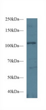 EPHA1 / EPH Receptor A1 Antibody - Western Blot; Sample: Human Hela cell lysate; Primary Ab: 1µg/ml Rabbit Anti-Mouse EPHA1 Antibody Second Ab: 0.2µg/mL HRP-Linked Caprine Anti-Rabbit IgG Polyclonal Antibody