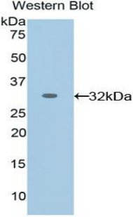 EPHA1 / EPH Receptor A1 Antibody - Western blot of recombinant EPHA1 / EPH Receptor A1.  This image was taken for the unconjugated form of this product. Other forms have not been tested.