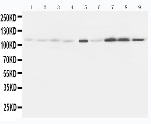 EPHA1 / EPH Receptor A1 Antibody - WB of EPHA1 / EPH Receptor A1 antibody. All lanes: Anti-EPHA1 at 0.5ug/ml. Lane 1: Rat Liver Tissue Lysate at 40ug. Lane 2: Rat Lung Tissue Lysate at 40ug. Lane 3: Rat Intestine Tissue Lysate at 40ug. Lane 4: Rat Ovary Tissue Lysate at 40ug. Lane 5: U87 Whole Cell Lysate at 40ug. Lane 6: A549 Whole Cell Lysate at 40ug. Lane 7: COLO320 Whole Cell Lysate at 40ug. Lane 8: SW620 Whole Cell Lysate at 40ug. Lane 9: HELA Whole Cell Lysate at 40ug. Predicted bind size: 108KD. Observed bind size: 108KD.