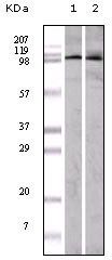 EPHA1 / EPH Receptor A1 Antibody - EphA1 Antibody in Western Blot (WB)