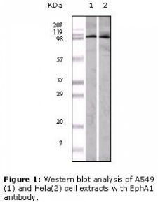 EPHA1 / EPH Receptor A1 Antibody