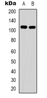 EPHA1 / EPH Receptor A1 Antibody - Western blot analysis of EPHA1 expression in HeLa (A); HepG2 (B) whole cell lysates.