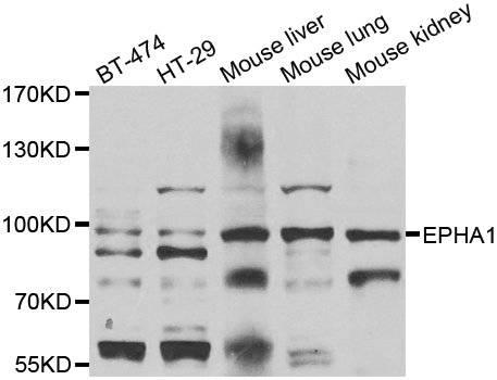 EPHA1 / EPH Receptor A1 Antibody - Western blot analysis of extracts of various cell lines.