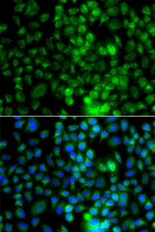 EPHA1 / EPH Receptor A1 Antibody - Immunofluorescence analysis of A549 cells.
