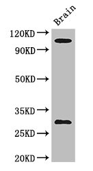 EPHA1 / EPH Receptor A1 Antibody - Positive WB detected in:Mouse brain tissue;All lanes: EPHA1 antibody at 3ug/ml;Secondary;Goat polyclonal to rabbit IgG at 1/50000 dilution;Predicted band size: 109,53,52 kDa;Observed band size: 109,30 kDa;