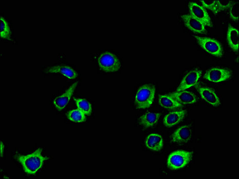 EPHA1 / EPH Receptor A1 Antibody - Immunofluorescent analysis of A549 cells using EPHA1 Antibody at a dilution of 1:100 and Alexa Fluor 488-congugated AffiniPure Goat Anti-Rabbit IgG(H+L)