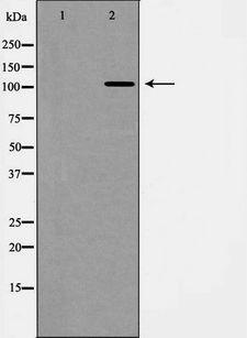 EPHA1 / EPH Receptor A1 Antibody - Western blot analysis of EPHA1 expression in COLO205 cells. The lane on the left is treated with the antigen-specific peptide.