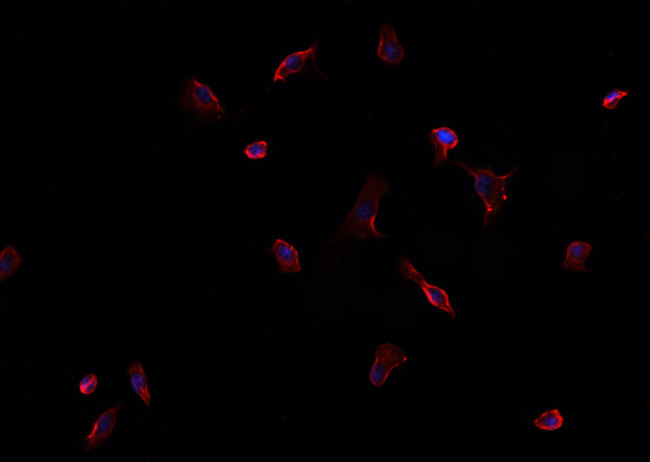 EPHA1 / EPH Receptor A1 Antibody - Staining HCT116 cells by IF/ICC. The samples were fixed with PFA and permeabilized in 0.1% Triton X-100, then blocked in 10% serum for 45 min at 25°C. The primary antibody was diluted at 1:200 and incubated with the sample for 1 hour at 37°C. An Alexa Fluor 594 conjugated goat anti-rabbit IgG (H+L) antibody, diluted at 1/600, was used as secondary antibody.