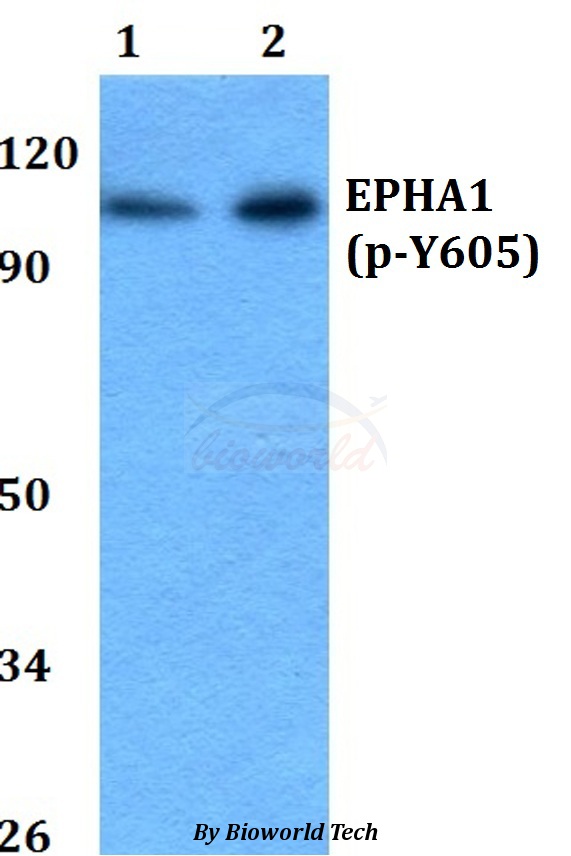 EPHA1 / EPH Receptor A1 Antibody - Western blot of p-EPHA1 (Y605) antibody at 1:500 dilution. Lane 1: A549 whole cell lysate. Lane 2: PC12 whole cell lysate.