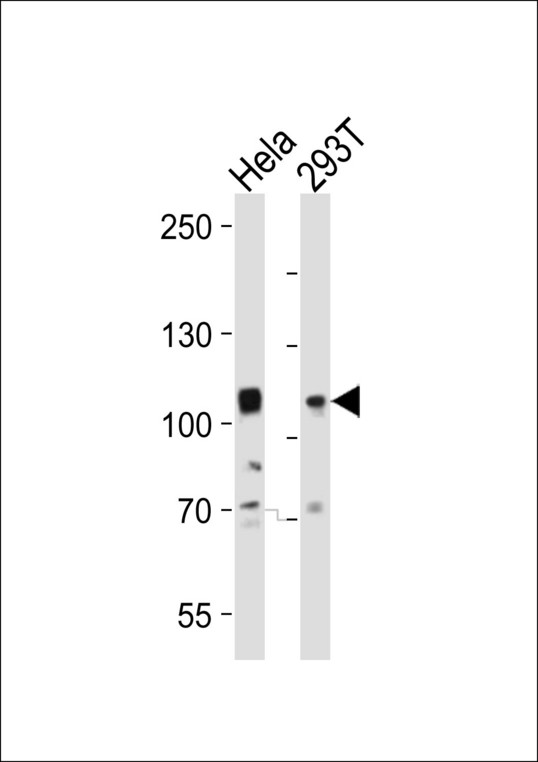 EPHA10 / EPH Receptor A10 Antibody - Western blot of lysates from HeLa, 293T cell line (from left to right), using EPHA10 Antibody. Antibody was diluted at 1:1000 at each lane. A goat anti-rabbit IgG H&L (HRP) at 1:10000 dilution was used as the secondary antibody. Lysates at 20ug per lane.