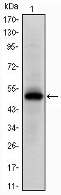 EPHA10 / EPH Receptor A10 Antibody - EphA10 Antibody in Western Blot (WB)