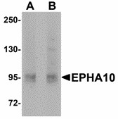 EPHA10 / EPH Receptor A10 Antibody - Western blot of EphA10 in 293 cell lysate with EphA10 antibody at (A) 1 ug/ml and (B) 2 ug/ml.