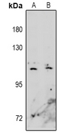 EPHA10 / EPH Receptor A10 Antibody - Western blot analysis of EPHA10 expression in A549 (A), Hela (B) whole cell lysates.