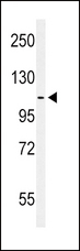EPHA2 / EPH Receptor A2 Antibody - Western blot of hEPHA2-T45 in MCF-7 cell line lysates (35 ug/lane). EPHA2 (arrow) was detected using the purified Pab