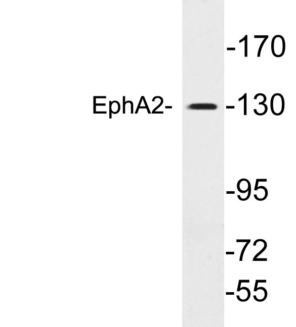 EPHA2 / EPH Receptor A2 Antibody - Western blot analysis of lysates from A549 cells , using EphA2 antibody.