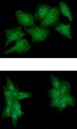 EPHA2 / EPH Receptor A2 Antibody - ICC/IF analysis of EPHA2 in HeLa cell line, stained monoclonal anti-human EPHA2 antibody (1:100) with goat anti-mouse IgG-Alexa fluor 488 conjugate (Green).ICC/IF analysis of EPHA2 in A431 cell line, stained monoclonal anti-human EPHA2 antibody (1:100) with goat anti-mouse IgG-Alexa fluor 488 conjugate (Green).