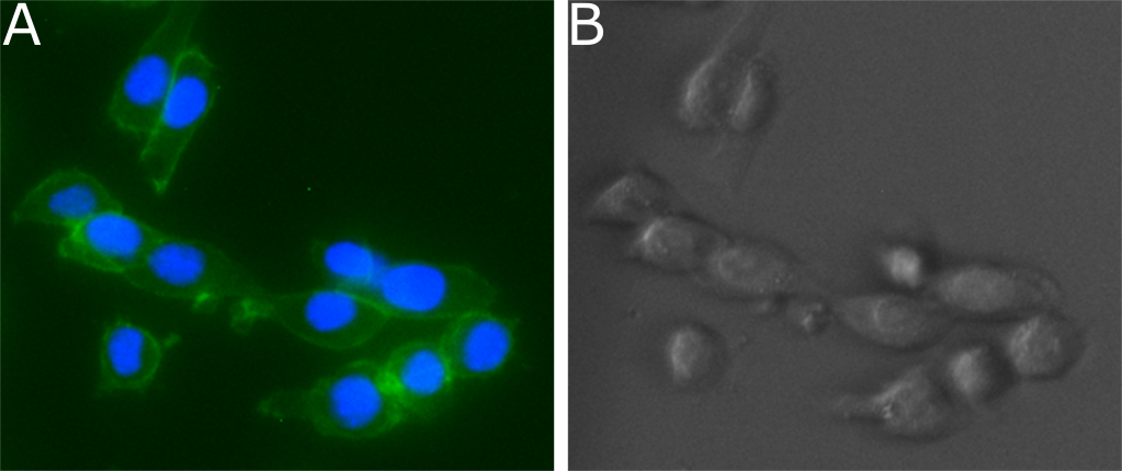 EPHA2 / EPH Receptor A2 Antibody - Immunofluorescence imaging on fixed LL/2 cells.