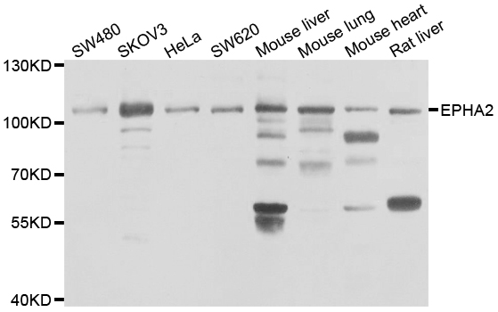 EPHA2 / EPH Receptor A2 Antibody - Western blot analysis of extracts of various cell lines.