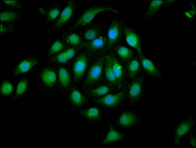 EPHA2 / EPH Receptor A2 Antibody - Immunofluorescence staining of A549 cells at a dilution of 1:133, counter-stained with DAPI. The cells were fixed in 4% formaldehyde, permeabilized using 0.2% Triton X-100 and blocked in 10% normal Goat Serum. The cells were then incubated with the antibody overnight at 4 °C.The secondary antibody was Alexa Fluor 488-congugated AffiniPure Goat Anti-Rabbit IgG (H+L) .