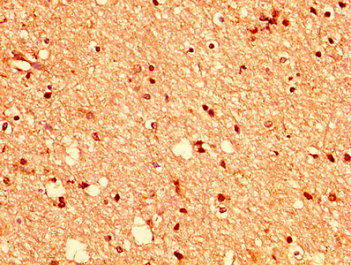 EPHA2 / EPH Receptor A2 Antibody - Immunohistochemistry image at a dilution of 1:400 and staining in paraffin-embedded human brain tissue performed on a Leica BondTM system. After dewaxing and hydration, antigen retrieval was mediated by high pressure in a citrate buffer (pH 6.0) . Section was blocked with 10% normal goat serum 30min at RT. Then primary antibody (1% BSA) was incubated at 4 °C overnight. The primary is detected by a biotinylated secondary antibody and visualized using an HRP conjugated SP system.