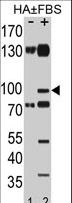 EPHA2 / EPH Receptor A2 Antibody - Western blot of EphA2 Antibody (pS897) antibody (RB21717) pre-incubated without(lane 1) and with(lane 2) FBS in HA cell line lysate. EphA2 Antibody (pS897) (arrow) was detected using the purified antibody(Kindly provided by Dr. John Wu).