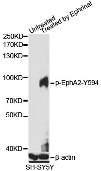 EPHA2 / EPH Receptor A2 Antibody - Western blot analysis of extracts of SH-SY5Y cells, using Phospho-EphA2-Y594 antibody at 1:1000 dilution. SH-SY5Y cells were treated by EphrinA1 (100 ng/ml) for 5 minutes. The secondary antibody used was an HRP Goat Anti-Rabbit IgG (H+L) at 1:10000 dilution. Lysates were loaded 25ug per lane and 3% nonfat dry milk in TBST was used for blocking. Blocking buffer: 3% BSA.An ECL Kit was used for detection and the exposure time was 60s.