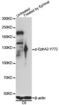 EPHA2 / EPH Receptor A2 Antibody - Western blot analysis of extracts of C6 cells, using Phospho-EphA2-Y772 antibody at 1:1000 dilution. C6 cells were treated by EphrinA1 (100 ng/ml) for 5 minutes. The secondary antibody used was an HRP Goat Anti-Rabbit IgG (H+L) at 1:10000 dilution. Lysates were loaded 25ug per lane and 3% nonfat dry milk in TBST was used for blocking. Blocking buffer: 3% BSA.An ECL Kit was used for detection and the exposure time was 90s.