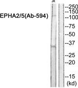 EPHA2 + EPHA5 Antibody - Western blot analysis of extracts from JK cells, using EPHA2/5 (Ab-594) Antibody.