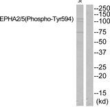 EPHA2 + EPHA5 Antibody - Western blot analysis of extracts from JK cells, using EPHA2/5 (Phospho-Tyr594) Antibody.