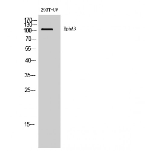 EPHA3 / EPH Receptor A3 Antibody - Western blot of EphA3 antibody