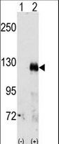 EPHA3 / EPH Receptor A3 Antibody - Western blot of EphA3(arrow) using rabbit polyclonal EphA3 Antibody.293 cell lysates (2 ug/lane) either nontransfected (Lane 1) or transiently transfected with the EphA3 gene (Lane 2) (Origene Technologies).