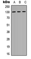EPHA3 / EPH Receptor A3 Antibody - Western blot analysis of EPHA2 expression in HeLa (A); Jurkat (B); NIH3T3 (C) whole cell lysates.