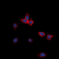 EPHA3 / EPH Receptor A3 Antibody - Immunofluorescent analysis of EPHA2 staining in HeLa cells. Formalin-fixed cells were permeabilized with 0.1% Triton X-100 in TBS for 5-10 minutes and blocked with 3% BSA-PBS for 30 minutes at room temperature. Cells were probed with the primary antibody in 3% BSA-PBS and incubated overnight at 4 ??C in a humidified chamber. Cells were washed with PBST and incubated with a DyLight 594-conjugated secondary antibody (red) in PBS at room temperature in the dark. DAPI was used to stain the cell nuclei (blue).