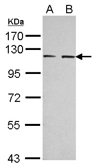EPHA3 / EPH Receptor A3 Antibody - Sample (30 ug of whole cell lysate) A: Jurkat: Raji 7.5% SDS PAGE EPHA3 antibody diluted at 1:3000