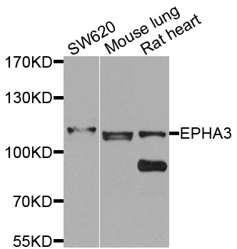 EPHA3 / EPH Receptor A3 Antibody - Western blot analysis of extracts of various cells.