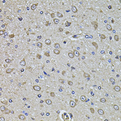 EPHA3 / EPH Receptor A3 Antibody - Immunohistochemistry of paraffin-embedded rat brain tissue.