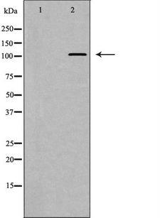 EPHA3 / EPH Receptor A3 Antibody - Western blot analysis of EPHA3 expression in 293 cells. The lane on the left is treated with the antigen-specific peptide.