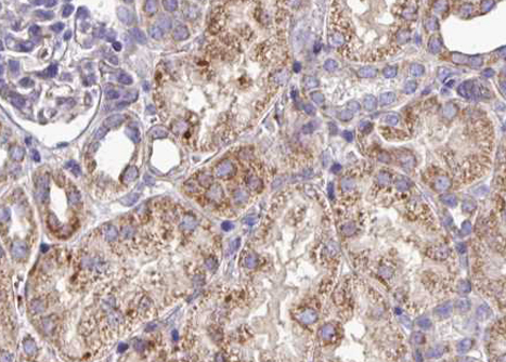 EPHA3 / EPH Receptor A3 Antibody - 1:100 staining human kidney tissue by IHC-P. The tissue was formaldehyde fixed and a heat mediated antigen retrieval step in citrate buffer was performed. The tissue was then blocked and incubated with the antibody for 1.5 hours at 22°C. An HRP conjugated goat anti-rabbit antibody was used as the secondary.