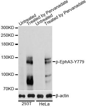 EPHA3 / EPH Receptor A3 Antibody - Western blot analysis of extracts of 293T and Hela cells, using Phospho-EphA3-Y779 antibody at 1:2000 dilution. 293T cells were treated by Pervanadate (1mM) for 30 minutes after serum-starvation overnight.HeLa cells were treated by Pervanadate (1nM) for 30 minutes after serum-starvation overnight. The secondary antibody used was an HRP Goat Anti-Rabbit IgG (H+L) at 1:10000 dilution. Lysates were loaded 25ug per lane and 3% nonfat dry milk in TBST was used for blocking. Blocking buffer: 3% BSA.An ECL Kit was used for detection and the exposure time was 1s.