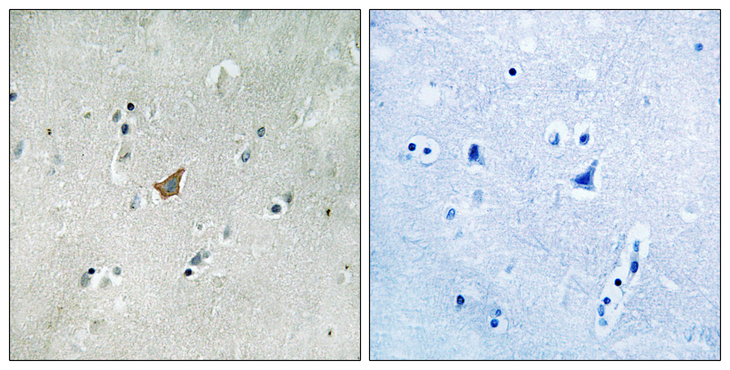 EPHA3 + EPHA4 + EPHA5 Antibody - Immunohistochemistry analysis of paraffin-embedded human brain, using EPHA3/4/5 (Phospho-Tyr779/833) Antibody. The picture on the right is blocked with the phospho peptide.