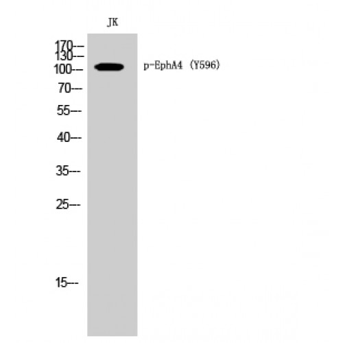 EPHA4 / EPH Receptor A4 Antibody - Western blot of Phospho-EphA4 (Y596) antibody