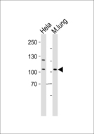 EPHA4 / EPH Receptor A4 Antibody - Western blot of lysates from HeLa cell line and mouse lung tissue lysate (from left to right) with Mouse Epha4 Antibody. Antibody was diluted at 1:1000 at each lane. A goat anti-rabbit IgG H&L (HRP) at 1:5000 dilution was used as the secondary antibody. Lysates at 35 ug per lane.