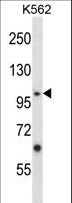 EPHA4 / EPH Receptor A4 Antibody - Mouse Epha4 Antibody western blot of K562 cell line lysates (35 ug/lane). The Epha4 antibody detected the Epha4 protein (arrow).