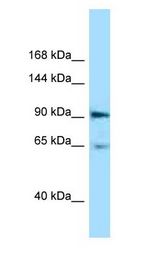 EPHA4 / EPH Receptor A4 Antibody - EPHA4 antibody Western Blot of Mouse Pancreas.  This image was taken for the unconjugated form of this product. Other forms have not been tested.