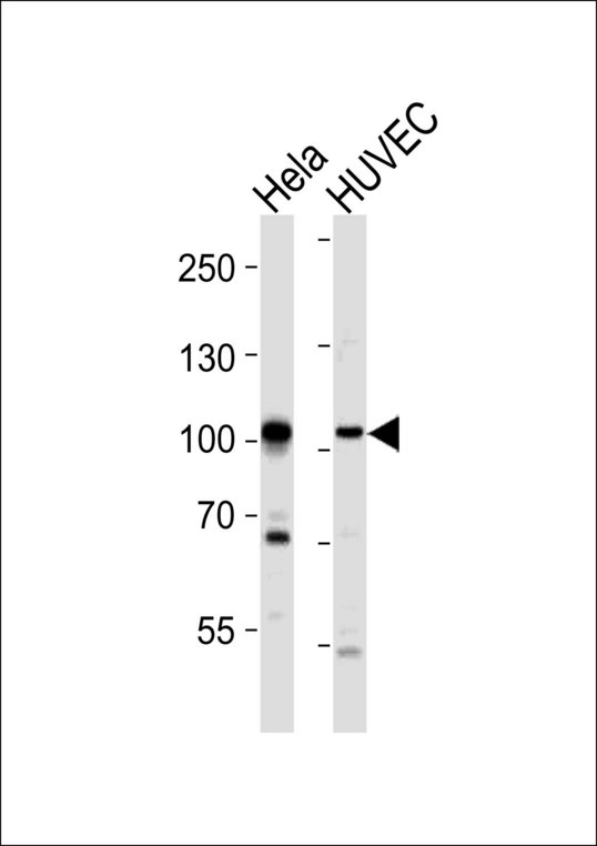EPHA4 / EPH Receptor A4 Antibody - Western blot of lysates from HeLa, HUVEC cell line (from left to right), using EPHA4 Antibody (R890). Antibody was diluted at 1:1000 at each lane. A goat anti-rabbit IgG H&L (HRP) at 1:10000 dilution was used as the secondary antibody. Lysates at 20ug per lane.