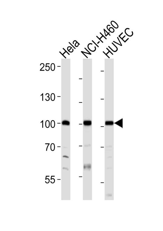EPHA4 / EPH Receptor A4 Antibody - Western blot of lysates from HeLa, NCI-H460, HUVEC cell line (from left to right), using EPHA4 Antibody (R890). Antibody was diluted at 1:1000 at each lane. A goat anti-rabbit IgG H&L (HRP) at 1:10000 dilution was used as the secondary antibody. Lysates at 20ug per lane.