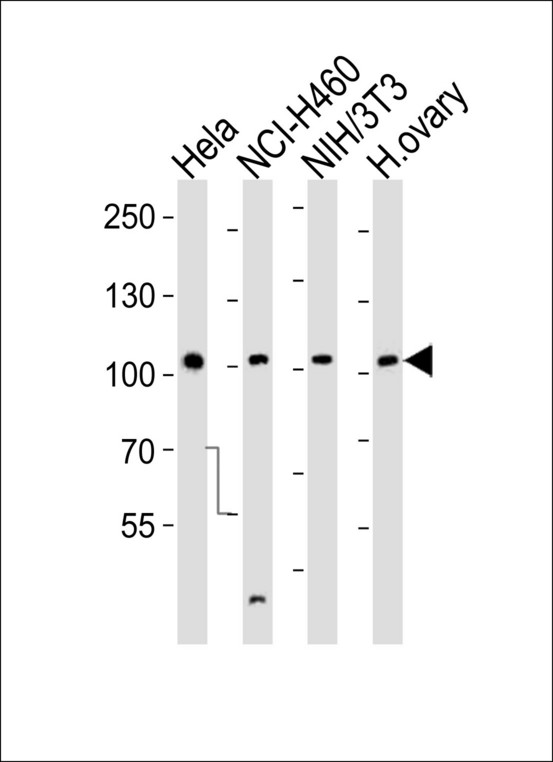 EPHA4 / EPH Receptor A4 Antibody - Western blot of lysates from HeLa, NCI-H460, mouse NIH/3T3 cell line and human ovary tissue lysate (from left to right), using EPHA4 Antibody (R890). Antibody was diluted at 1:1000 at each lane. A goat anti-rabbit IgG H&L (HRP) at 1:10000 dilution was used as the secondary antibody. Lysates at 35ug per lane.