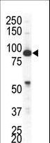 EPHA4 / EPH Receptor A4 Antibody - Western blot of anti-EphA4 antibody in NCI-H460 cell lysate. EphA4 (arrow) was detected using purified antibody. Secondary HRP-anti-rabbit was used for signal visualization with chemiluminescence.